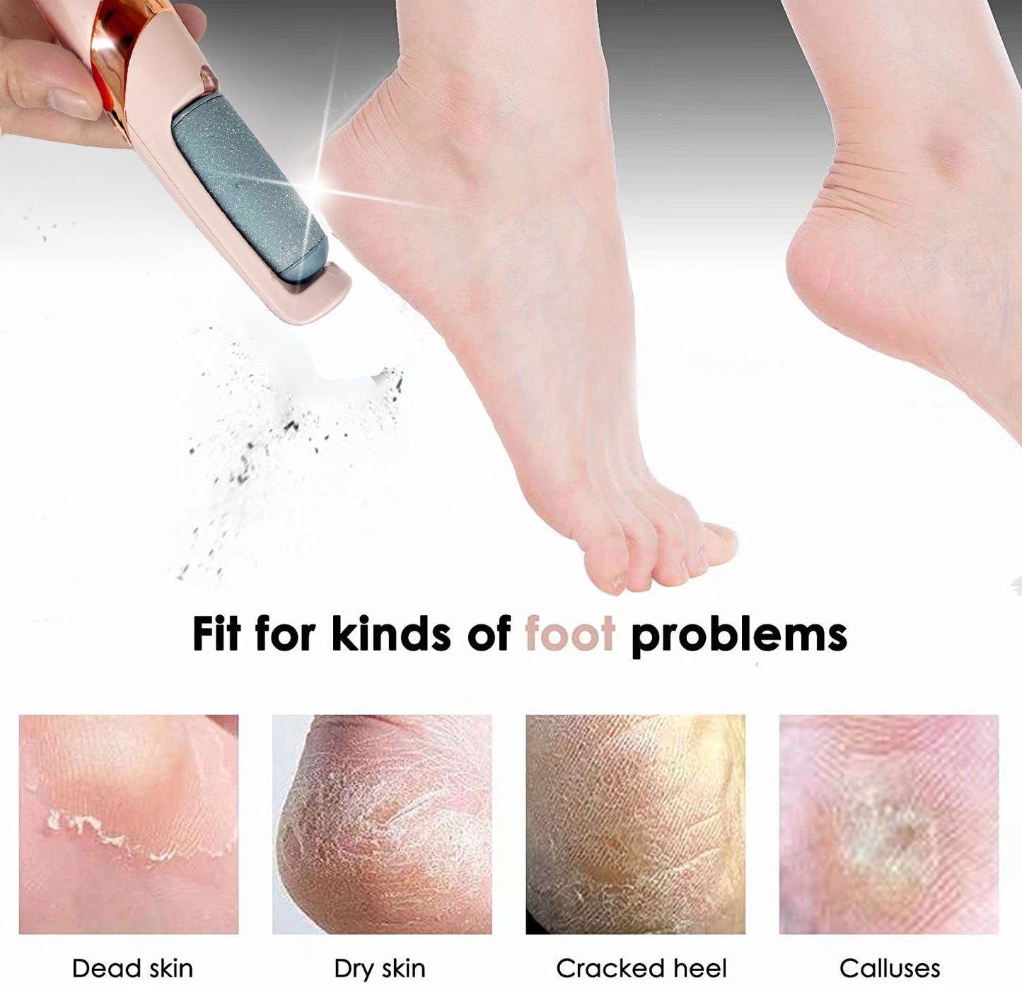 Pedicure Tool Callus Remover